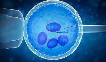 IVF with Donor Eggs