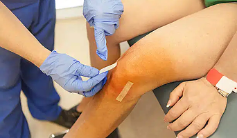 Knee Replacement Total or Partial