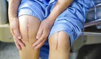 Knee Surgery