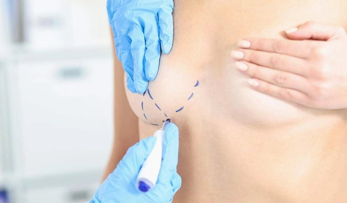 Nipple Inversion Correction