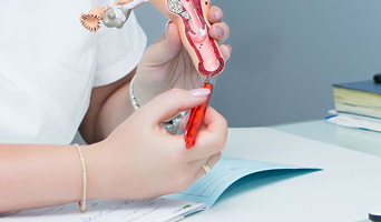 Ovulation Induction (OI)