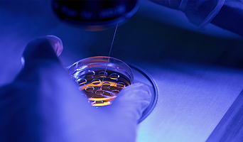 Preimplantation Genetic Diagnosis (PGD)