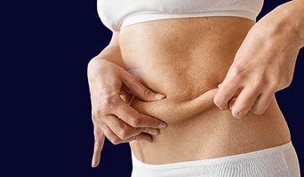 Roux en Y Gastric Bypass