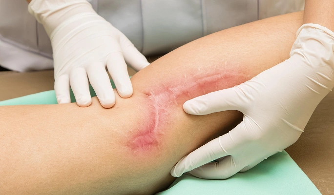 Scars and Deformities