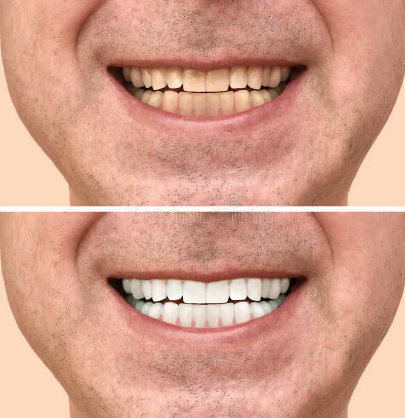 Dentistry patient 3