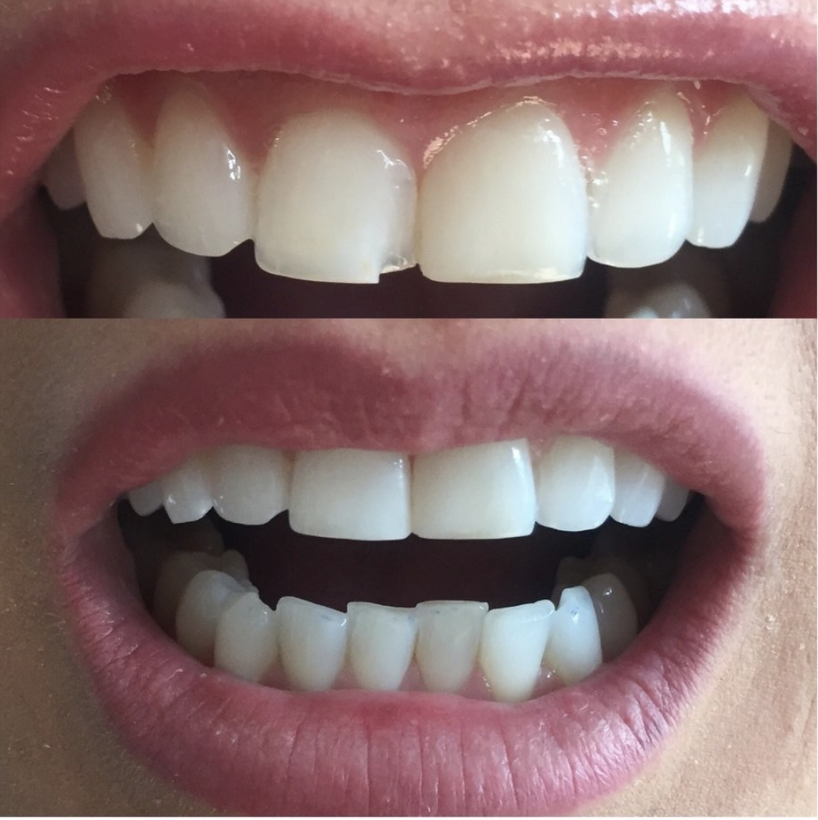Dentistry patient 1