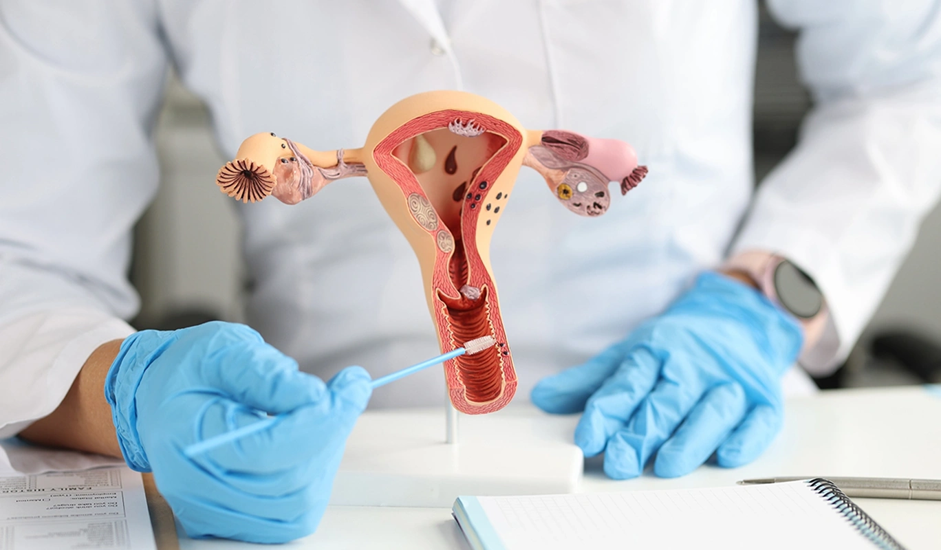 Gynecology Treatment